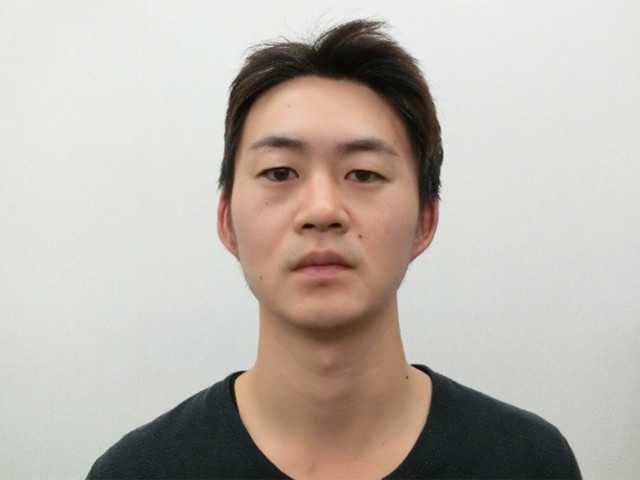 小顔・顔の歪み矯正　Ｓ．Ｋさん（３４歳）