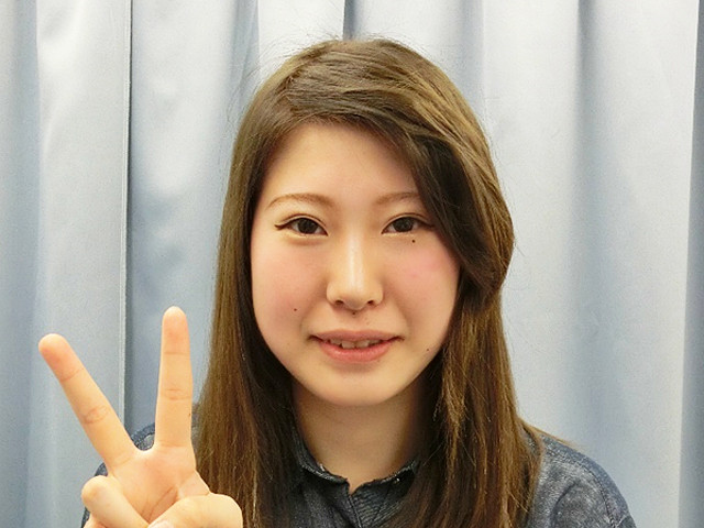 小顔・顔の歪み矯正（Ｓ．Ａさん２０歳）