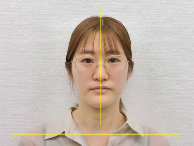 【美容整体】全身根本改善コース 20代女性