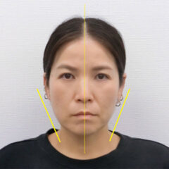 全身根本改善コース 40代女性