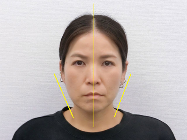 全身根本改善コース 40代女性