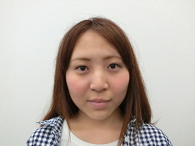 小顔・顔の歪み矯正 Ｕ．Ｆさん（23歳）